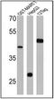 Glutathione-S-Transferase Tag antibody, PA1-982A, Invitrogen Antibodies, Western Blot image 