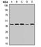 Receptor activity-modifying protein 3 antibody, LS-B15834, Lifespan Biosciences, Western Blot image 