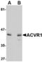 Activin A Receptor Type 1 antibody, LS-C83919, Lifespan Biosciences, Western Blot image 