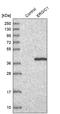 Endoplasmic Reticulum-Golgi Intermediate Compartment 1 antibody, PA5-53874, Invitrogen Antibodies, Western Blot image 