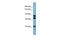 Peroxidasin antibody, PA5-42155, Invitrogen Antibodies, Western Blot image 