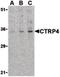 C1q And TNF Related 4 antibody, LS-B1342, Lifespan Biosciences, Western Blot image 