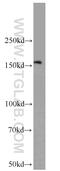 Kinesin Family Member 15 antibody, 55407-1-AP, Proteintech Group, Western Blot image 