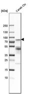 Phosphatase And Actin Regulator 1 antibody, HPA029755, Atlas Antibodies, Western Blot image 
