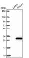 Phosphopantothenoylcysteine Decarboxylase antibody, NBP2-13792, Novus Biologicals, Western Blot image 