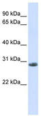 Yip1 Domain Family Member 6 antibody, TA329513, Origene, Western Blot image 