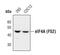 Eukaryotic Translation Initiation Factor 4A1 antibody, PA5-17258, Invitrogen Antibodies, Western Blot image 