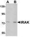 Interleukin 1 Receptor Associated Kinase 1 antibody, TA319667, Origene, Western Blot image 