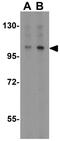 Mdm2-binding protein antibody, GTX31662, GeneTex, Western Blot image 