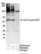 Serine/threonine-protein kinase Chk1 antibody, A304-673A, Bethyl Labs, Western Blot image 