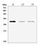 Pre T-cell antigen receptor alpha antibody, A10240-1, Boster Biological Technology, Western Blot image 