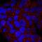 UDP-glucuronosyltransferase 1-1 antibody, PA5-47844, Invitrogen Antibodies, Immunocytochemistry image 