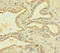 PTPN13 Like Y-Linked 2 antibody, LS-C397049, Lifespan Biosciences, Immunohistochemistry paraffin image 