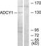 Adenylate cyclase type 1 antibody, TA311696, Origene, Western Blot image 