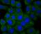 Placenta growth factor antibody, A01164-3, Boster Biological Technology, Immunocytochemistry image 