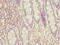 SPT20 Homolog, SAGA Complex Component antibody, LS-C676562, Lifespan Biosciences, Immunohistochemistry paraffin image 