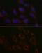 Branched Chain Amino Acid Transaminase 2 antibody, GTX33036, GeneTex, Immunocytochemistry image 