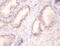 U1 small nuclear ribonucleoprotein A antibody, CSB-PA00974A0Rb, Cusabio, Immunohistochemistry paraffin image 