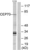 Centrosomal Protein 70 antibody, GTX87611, GeneTex, Western Blot image 
