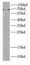 Doublesex- and mab-3-related transcription factor A1 antibody, FNab02426, FineTest, Western Blot image 