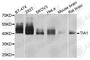 TIA1 Cytotoxic Granule Associated RNA Binding Protein antibody, A6237, ABclonal Technology, Western Blot image 