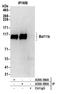 BAF Chromatin Remodeling Complex Subunit BCL11B antibody, A300-385A, Bethyl Labs, Immunoprecipitation image 