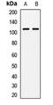 N(Alpha)-Acetyltransferase 25, NatB Auxiliary Subunit antibody, LS-C668973, Lifespan Biosciences, Western Blot image 