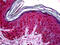 Tumor Susceptibility 101 antibody, 51-816, ProSci, Immunohistochemistry frozen image 