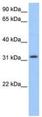 Zinc Finger C2HC-Type Containing 1C antibody, TA335958, Origene, Western Blot image 
