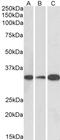 RP3 antibody, PA5-19255, Invitrogen Antibodies, Western Blot image 