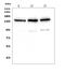 PH Domain And Leucine Rich Repeat Protein Phosphatase 1 antibody, A02430-1, Boster Biological Technology, Western Blot image 