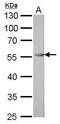 POU Class 3 Homeobox 2 antibody, PA5-30124, Invitrogen Antibodies, Western Blot image 