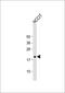 High mobility group protein HMG-I/HMG-Y antibody, GTX80558, GeneTex, Western Blot image 