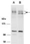 AT-Rich Interaction Domain 1B antibody, orb66906, Biorbyt, Western Blot image 