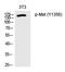 c-met antibody, PA5-40218, Invitrogen Antibodies, Western Blot image 