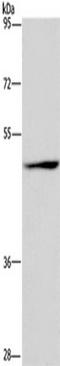 Sialic acid-binding Ig-like lectin 9 antibody, TA349776, Origene, Western Blot image 