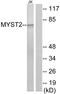 Lysine Acetyltransferase 7 antibody, A30463, Boster Biological Technology, Western Blot image 