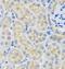 Stp antibody, FNab08376, FineTest, Immunohistochemistry frozen image 