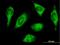 Histidyl-TRNA Synthetase antibody, H00003035-B01P, Novus Biologicals, Immunocytochemistry image 