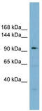 Squamous cell carcinoma antigen recognized by T-cells 3 antibody, TA343751, Origene, Western Blot image 