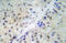 Estrogen Receptor 1 antibody, AP21025PU-N, Origene, Immunohistochemistry paraffin image 