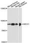 ATP Binding Cassette Subfamily G Member 1 antibody, LS-C748222, Lifespan Biosciences, Western Blot image 