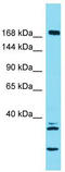 Kinesin Family Member 27 antibody, TA334699, Origene, Western Blot image 