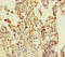 Coiled-Coil Domain Containing 184 antibody, LS-C395115, Lifespan Biosciences, Immunohistochemistry paraffin image 