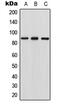 Ral Guanine Nucleotide Dissociation Stimulator Like 1 antibody, GTX55936, GeneTex, Western Blot image 