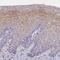 Multivesicular Body Subunit 12A antibody, NBP1-91883, Novus Biologicals, Immunohistochemistry frozen image 