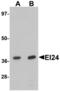 EI24 Autophagy Associated Transmembrane Protein antibody, A06183, Boster Biological Technology, Western Blot image 
