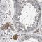 Squalene monooxygenase antibody, HPA018038, Atlas Antibodies, Immunohistochemistry frozen image 