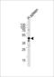 Charged Multivesicular Body Protein 6 antibody, LS-C168741, Lifespan Biosciences, Western Blot image 