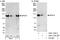 Epidermal Growth Factor Receptor Pathway Substrate 15 antibody, A301-733A, Bethyl Labs, Immunoprecipitation image 
